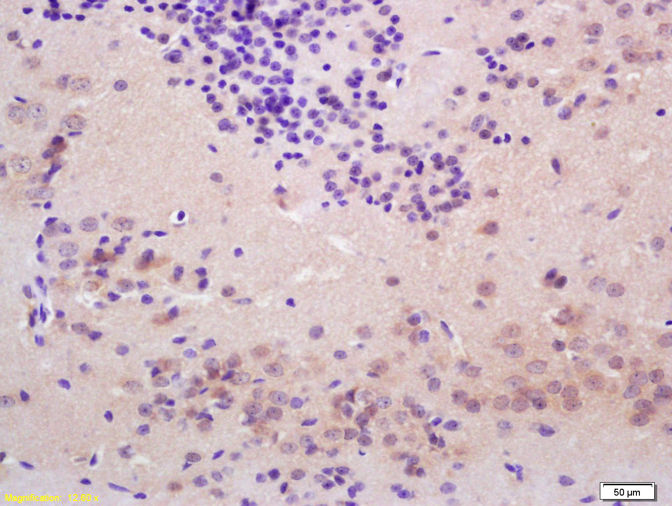 14 - Thyroid peroxidase Rabbit pAb AP54256