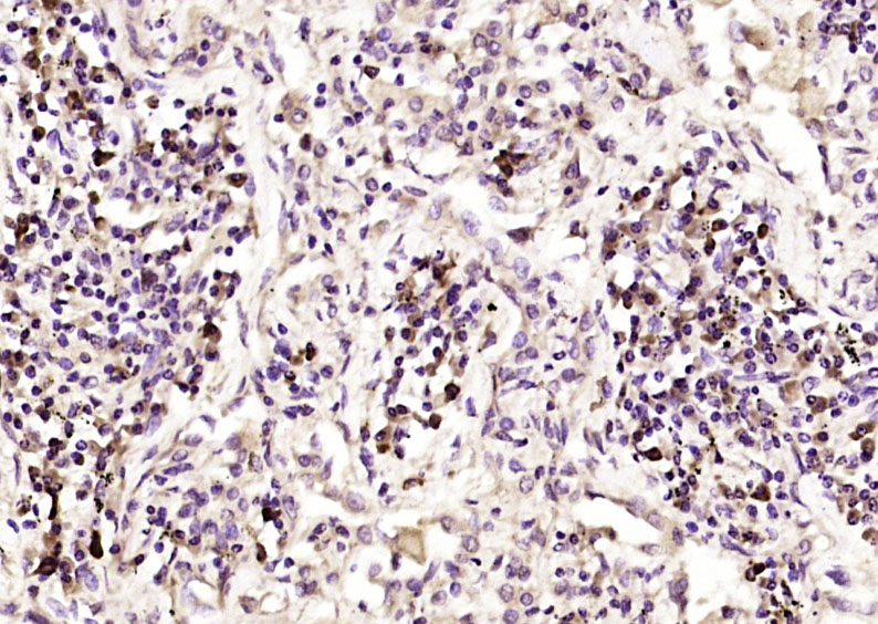 14 - CTR1 Rabbit pAb AP54312