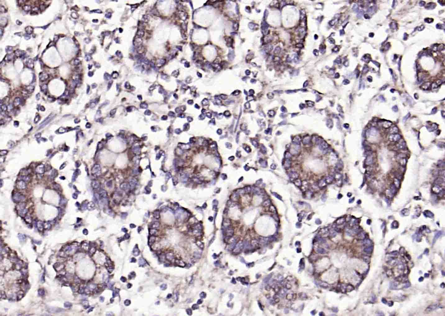 14 - FUT2 Rabbit pAb AP54798