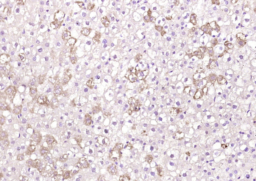 14 - ApoM Rabbit pAb AP54867