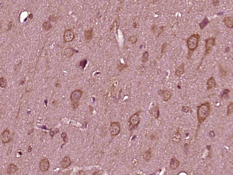 14 - TMEM85 Rabbit pAb AP54927