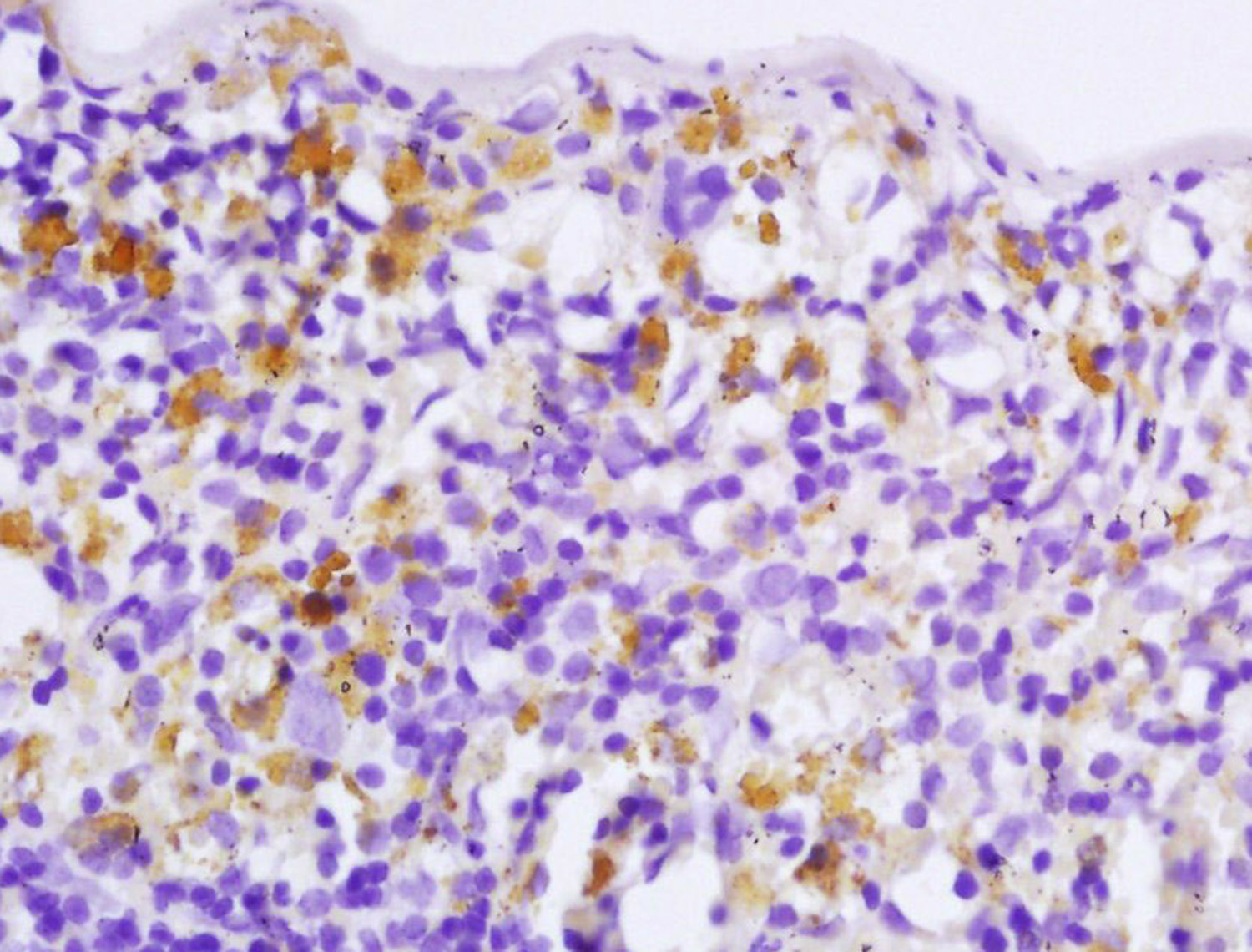 14 - EPB41 Rabbit pAb AP55057