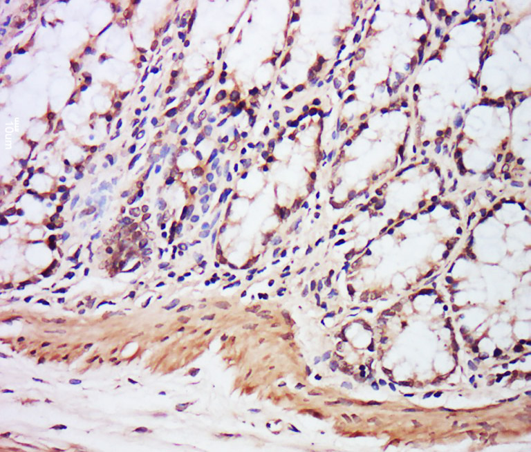 14 - EXOSC7 Rabbit pAb AP55068