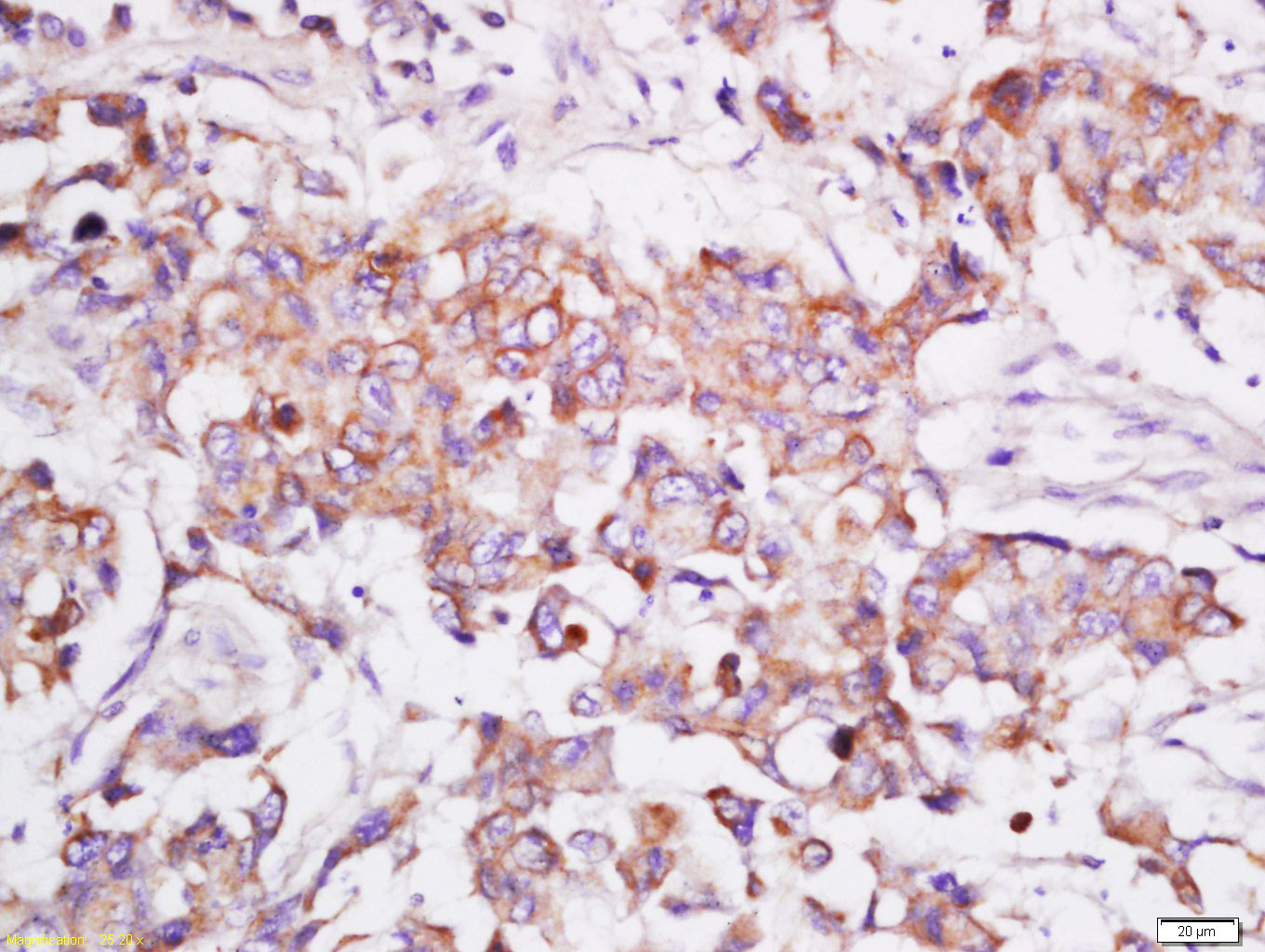 14 - GFPT1 Rabbit pAb AP55140