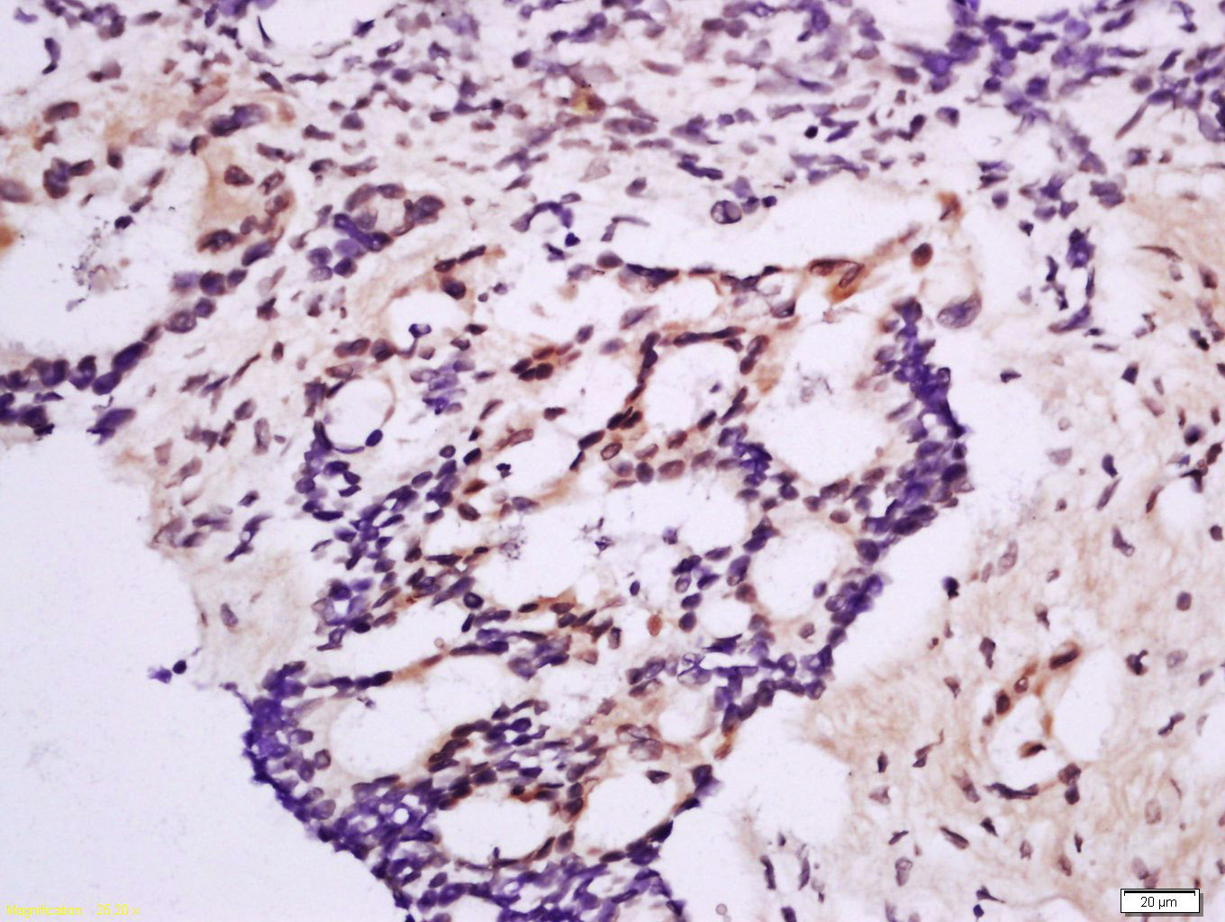 14 - HOXD8 Rabbit pAb AP55215