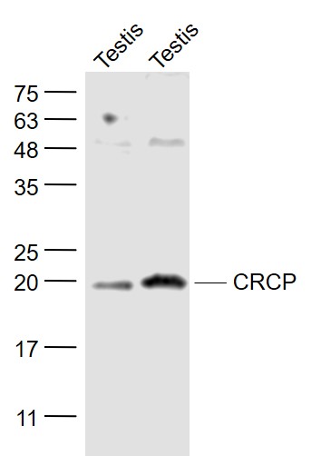 1 - CRCP Rabbit pAb AP55397