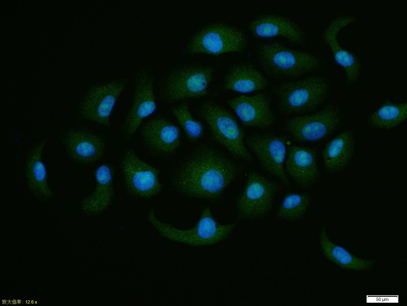 0 - eIF4A3 Rabbit pAb AP55620