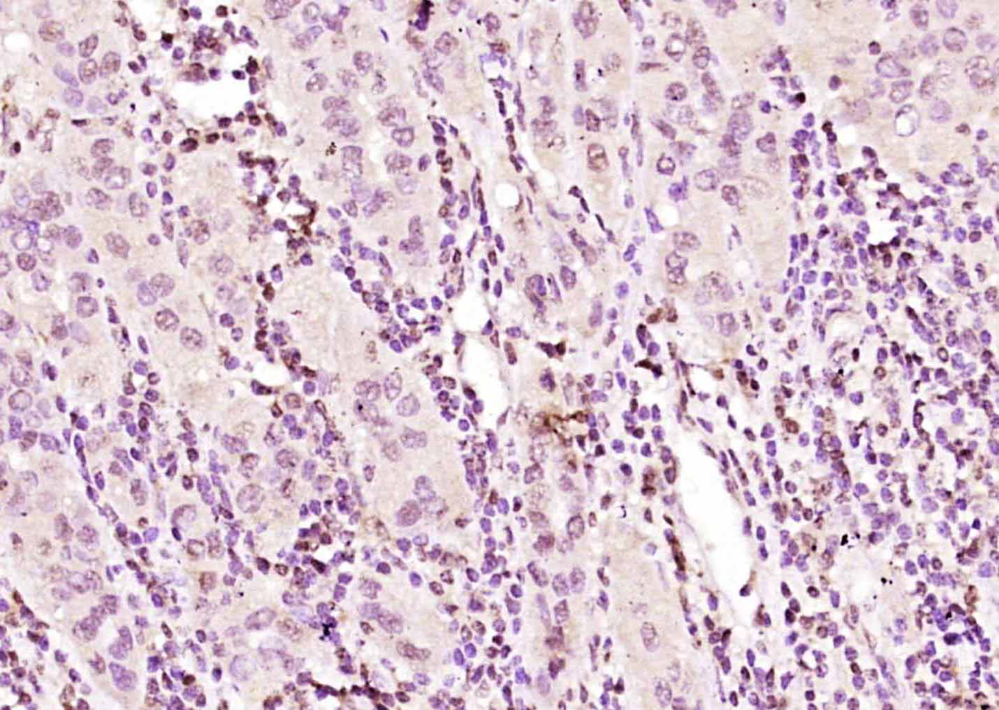 14 - eIF4A3 Rabbit pAb AP55620