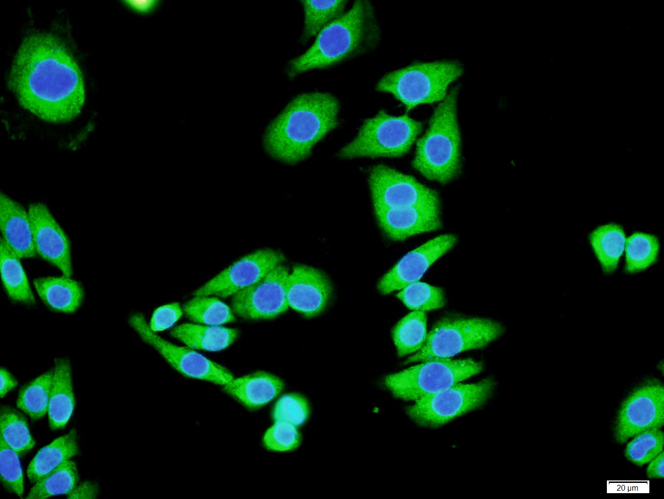 0 - Gamma-Adaptin Rabbit pAb AP56062