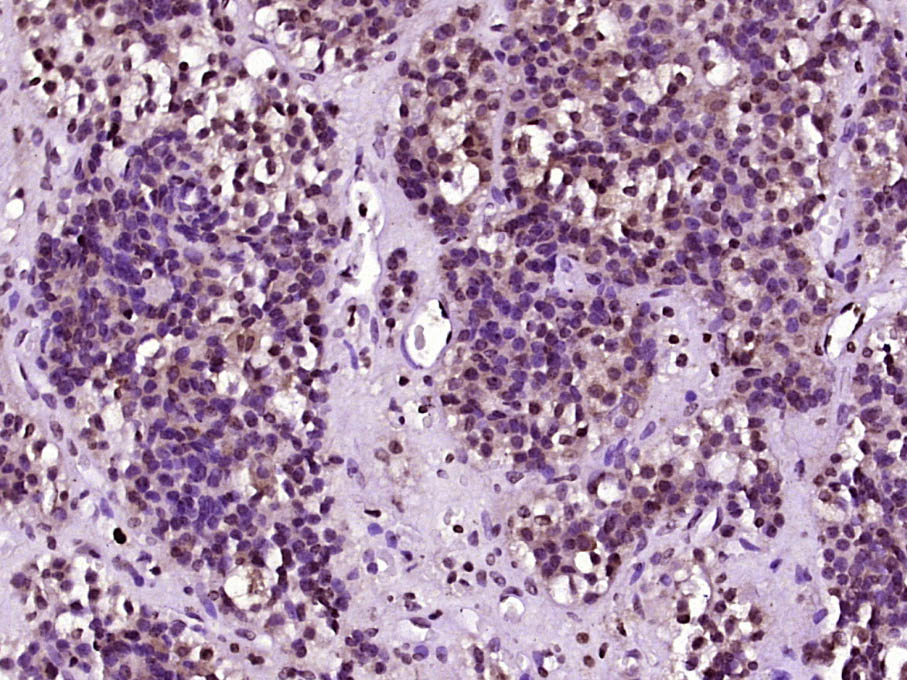 14 - INSM1 Rabbit pAb AP56356