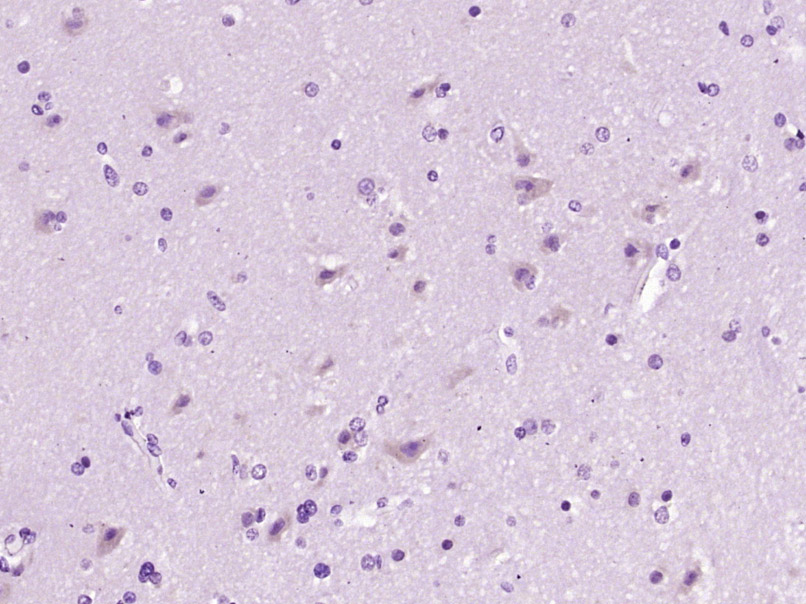 14 - Profilin 2 Rabbit pAb AP57235