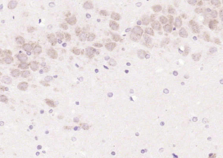 14 - LCAT Rabbit pAb AP57642