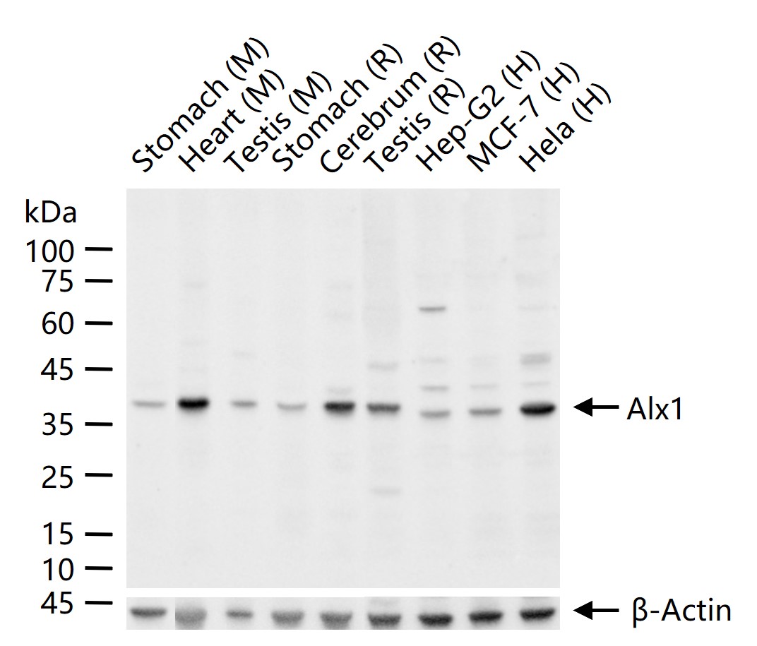 1 - Alx1 Rabbit pAb AP57794