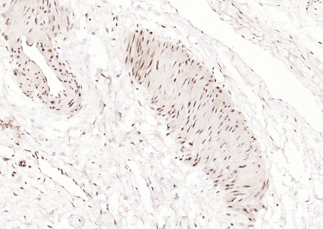 14 - Alx1 Rabbit pAb AP57794