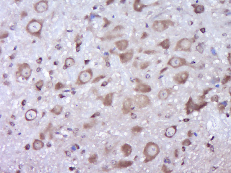 14 - PLA2G2A Rabbit pAb AP57800