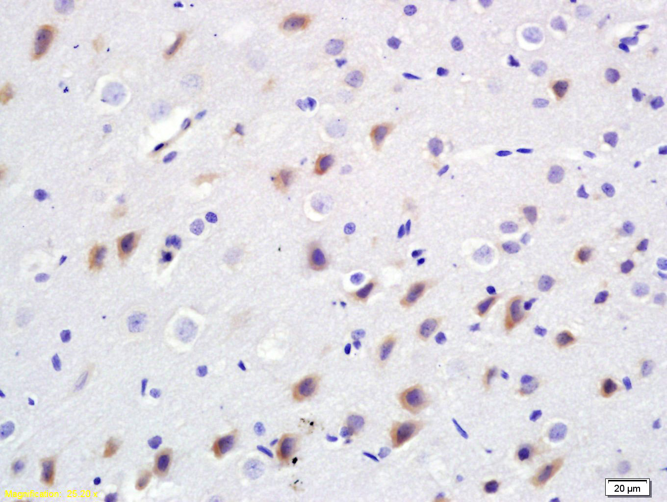 14 - BDKRB2 Rabbit pAb AP58023