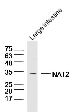 1 - NAT2 Rabbit pAb AP58059