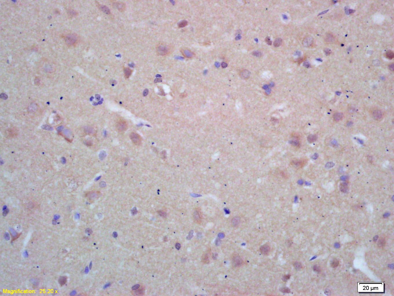 14 - NAT2 Rabbit pAb AP58059