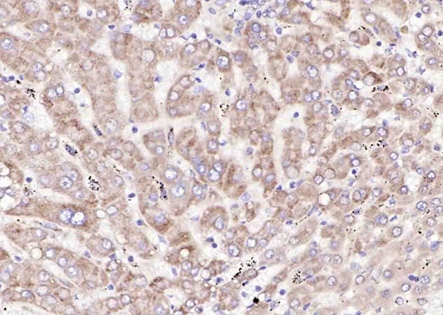 14 - SLC44A1 Rabbit pAb AP58088