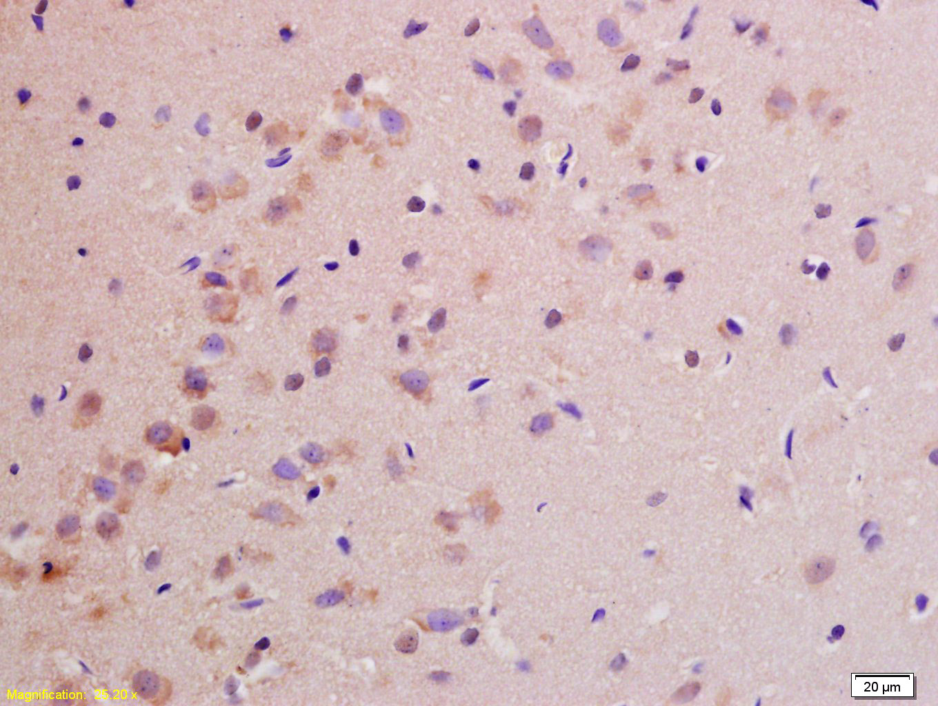 14 - NDUFS1 Rabbit pAb AP58106