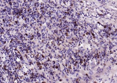 14 - IL-2 Rabbit pAb AP58236