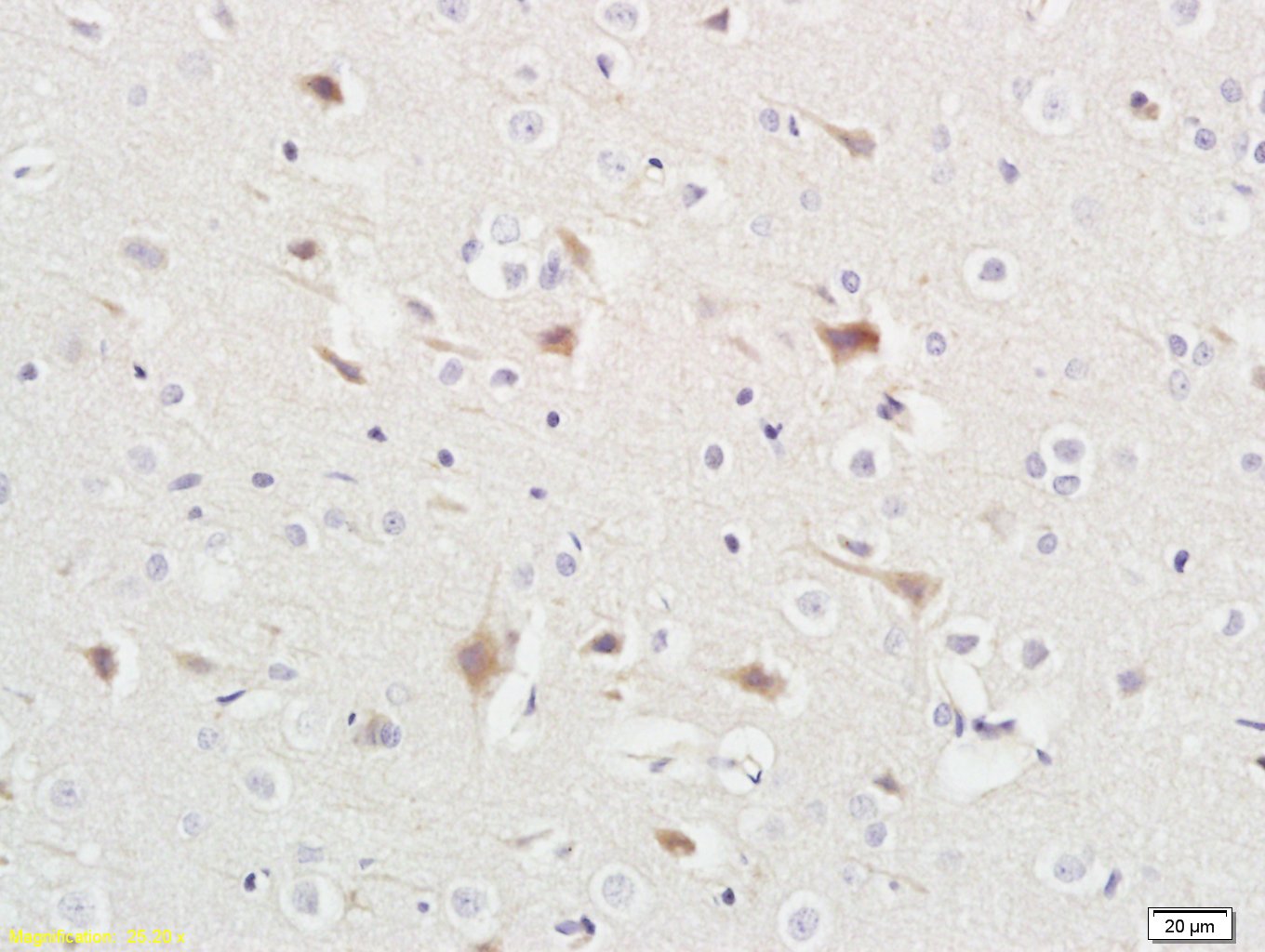 14 - ABHD5 Rabbit pAb AP58263