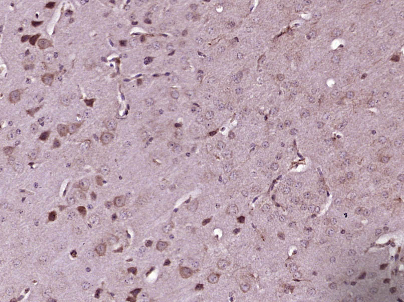 14 - ACOX2 Rabbit pAb AP58264