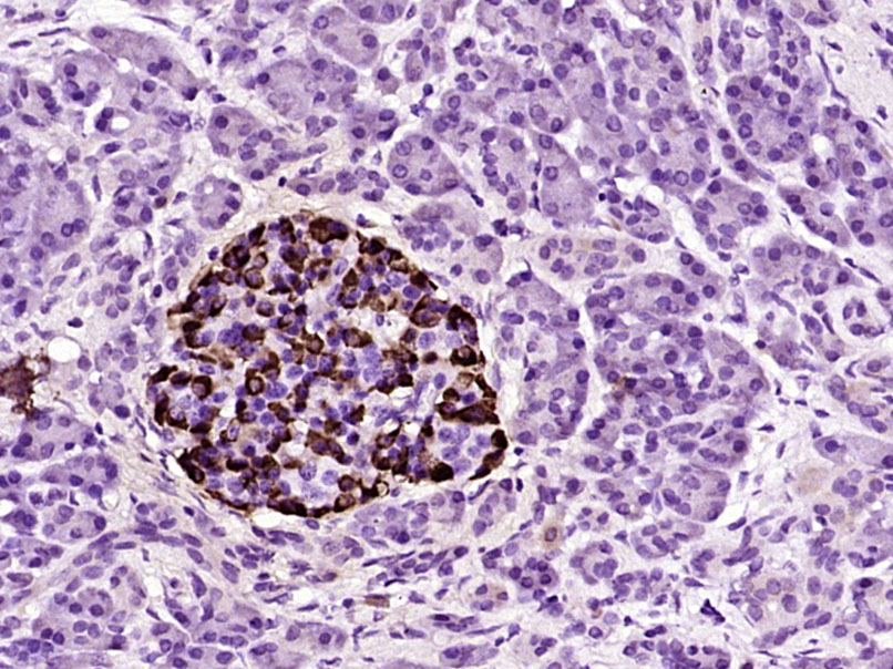 14 - IDI1 Rabbit pAb AP58272