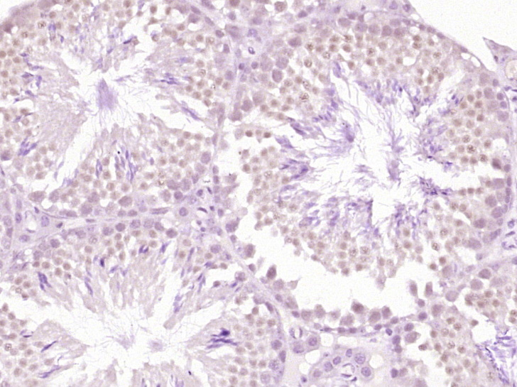 14 - TKTL1 Rabbit pAb AP58409