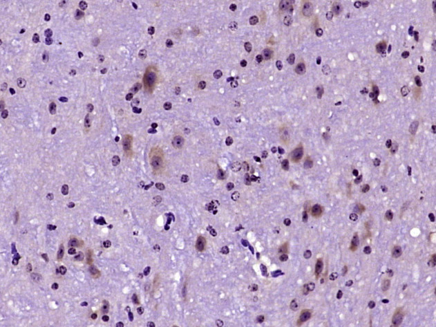 14 - Phospholipase C beta 2 Rabbit pAb AP58450