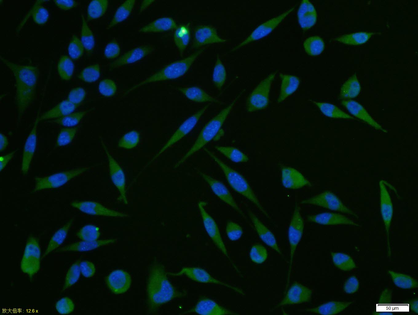 0 - CARD14 Rabbit pAb AP58588