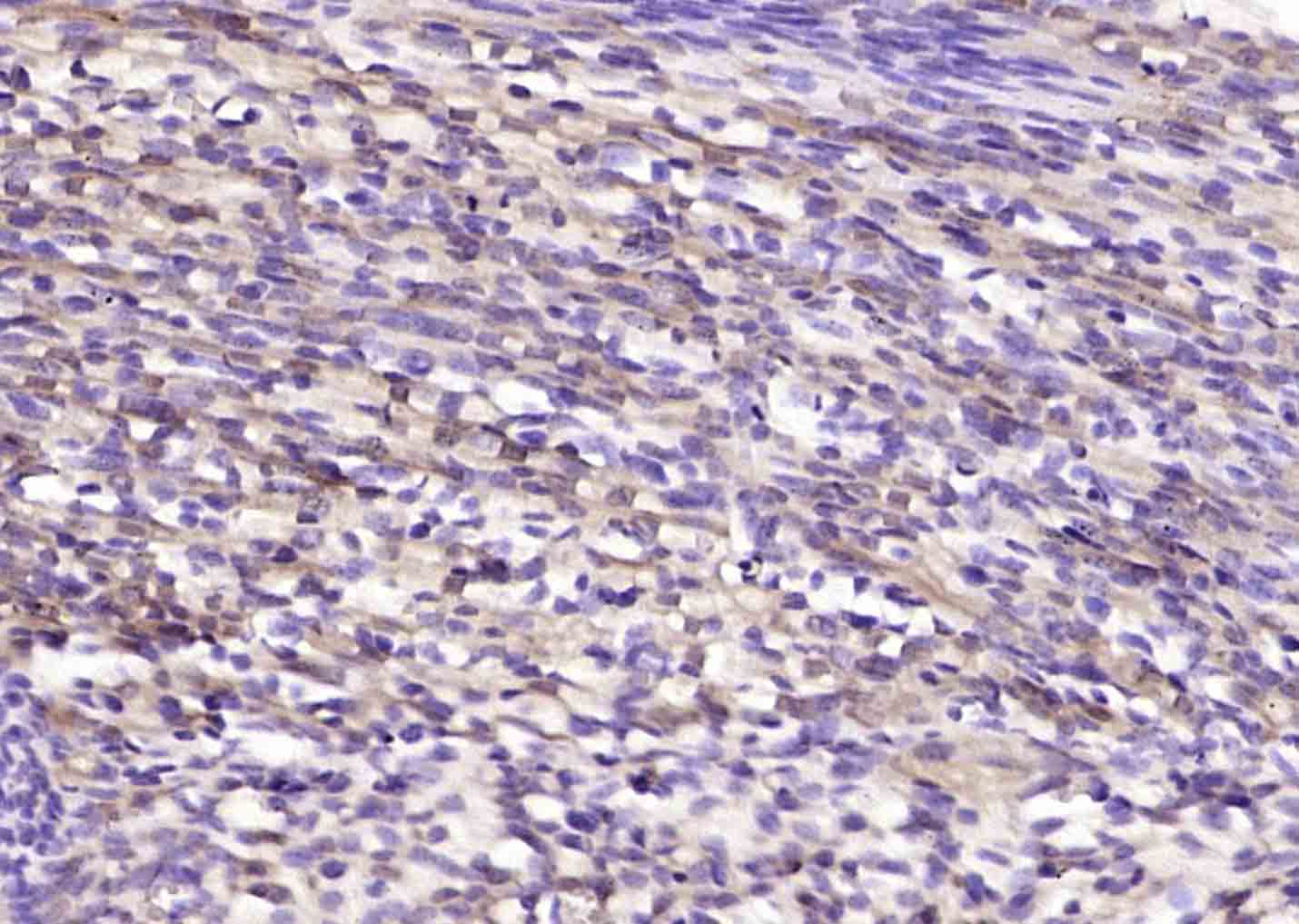 14 - CAPD2 Rabbit pAb AP58729