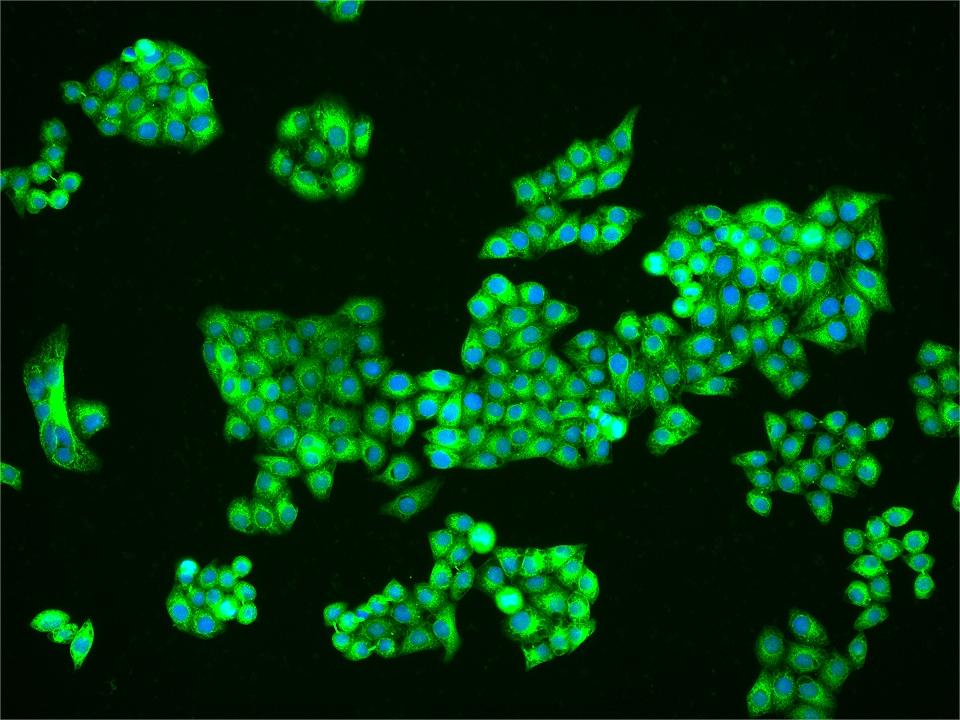 0 - ENC1 Rabbit pAb AP58844