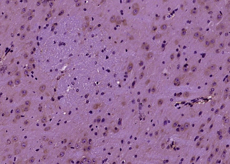 14 - ENC1 Rabbit pAb AP58844