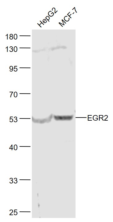 1 - EGR2 Rabbit pAb AP58977