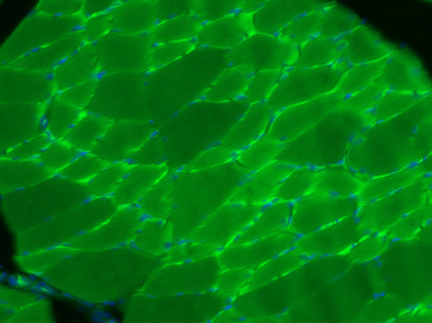 3 - Desmuslin Rabbit pAb AP59036