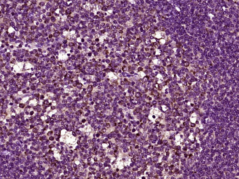 14 - GPBAR1 Rabbit pAb AP59093