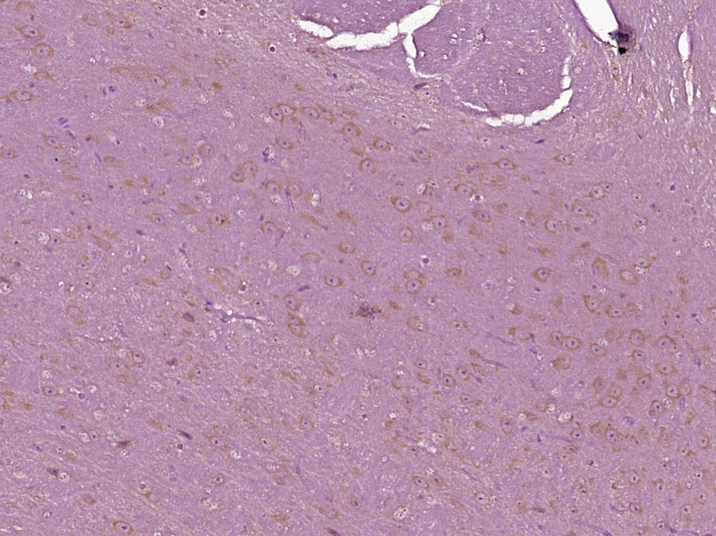 14 - Thymosin beta 4 Rabbit pAb AP59410