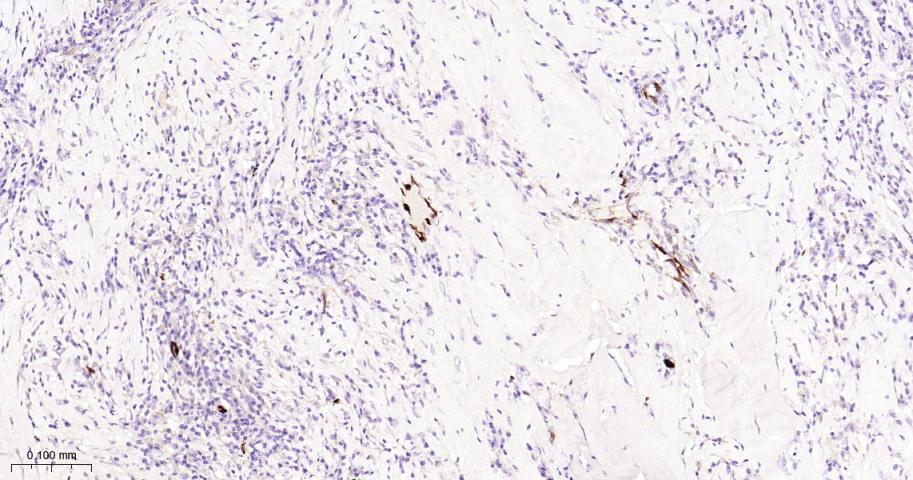 14 - FABP4 Mouse mAb AP59464