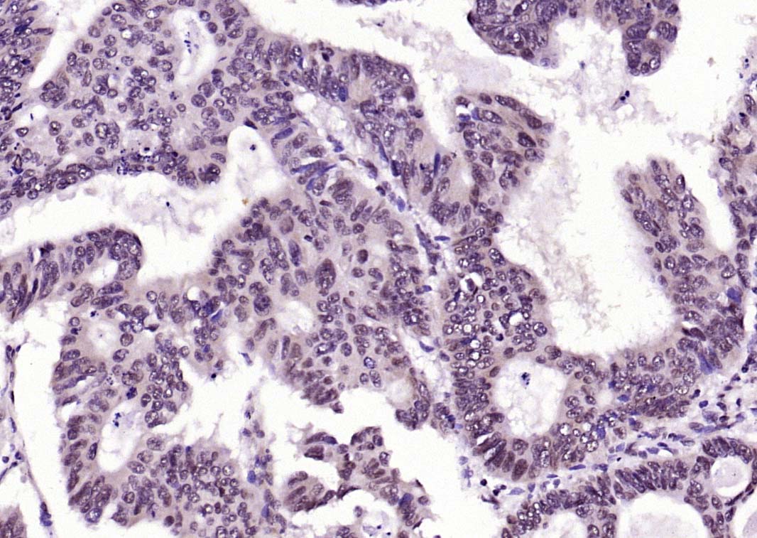 14 - phospho-FADD (Ser194) Rabbit pAb AP93921