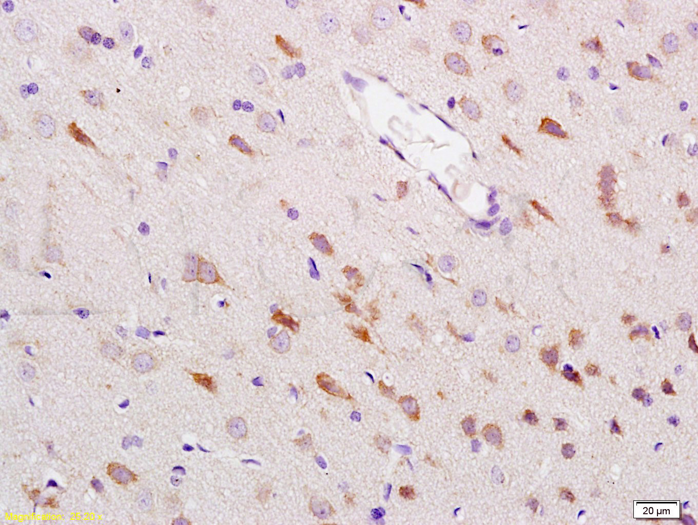 14 - HSP70 Rabbit pAb AP93927