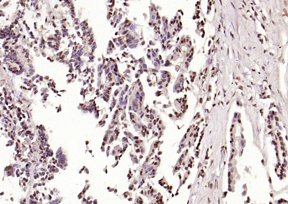 14 - phospho-HSP70 (Tyr611) Rabbit pAb AP93957