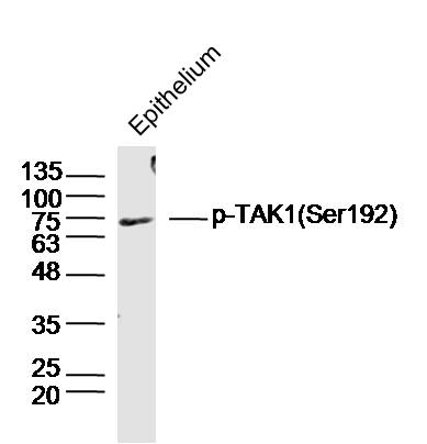 1 - phospho-HSP70 (Tyr41) Rabbit pAb AP93958
