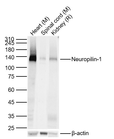 1 - Neuropilin-1 Recombinant Rabbit mAb AP94009