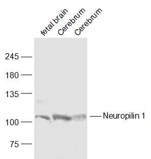 1 - Neuropilin 1 Rabbit pAb AP94057