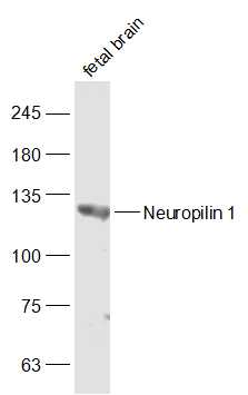 1 - Neuropilin 1 Rabbit pAb AP94059