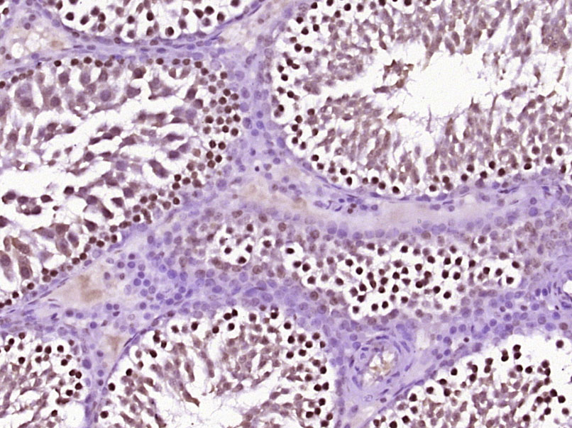 14 - HSP70 Rabbit pAb AP94116