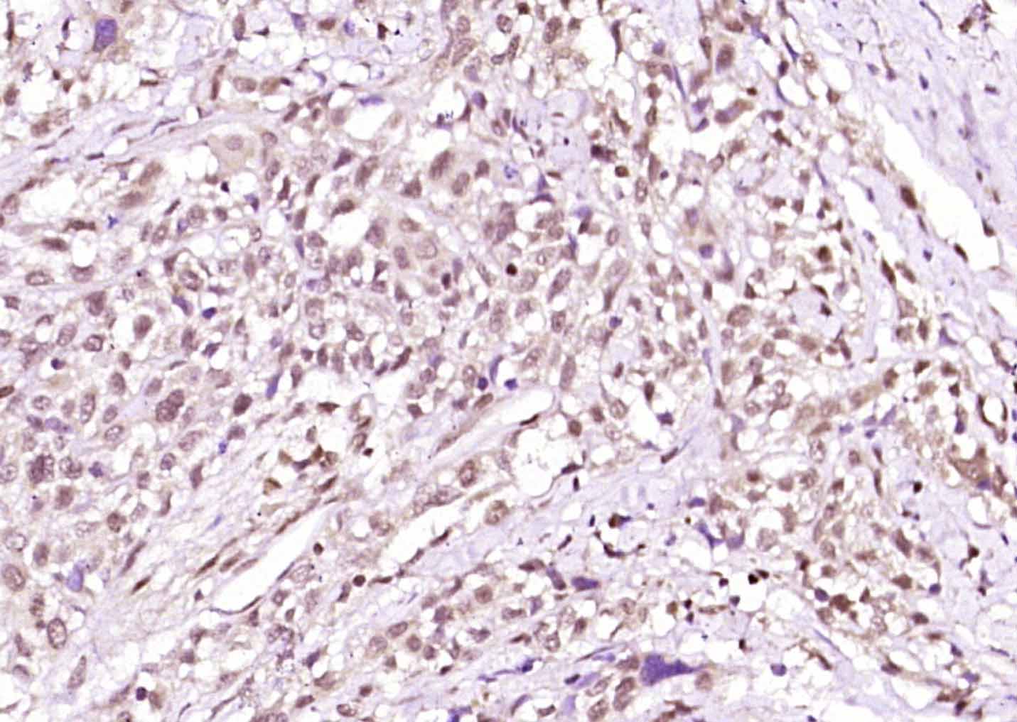 14 - phospho-PKA alpha + beta (Thr198) Rabbit pAb AP94208