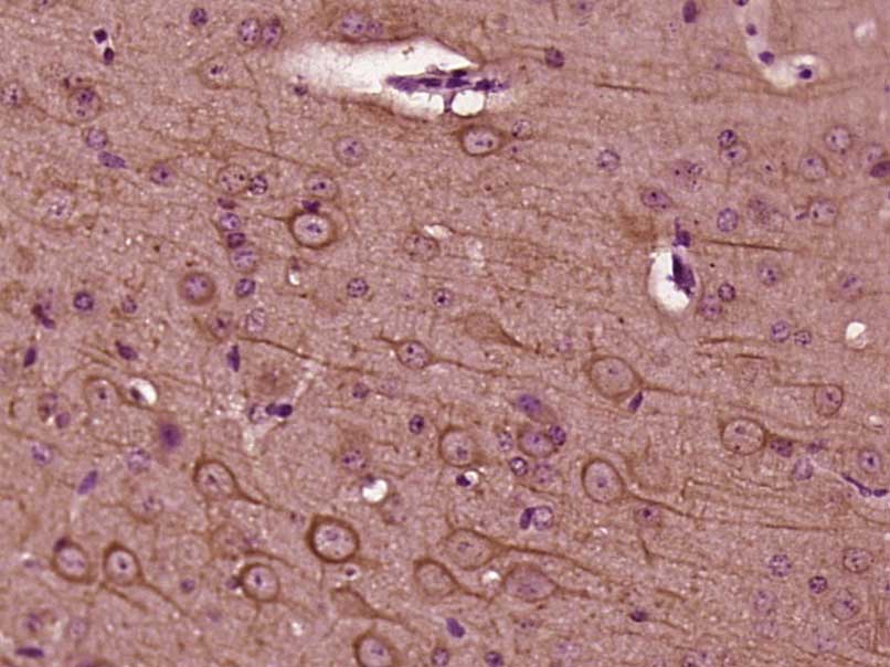 14 - phospho-BCL10 (Ser218) Rabbit pAb AP94419