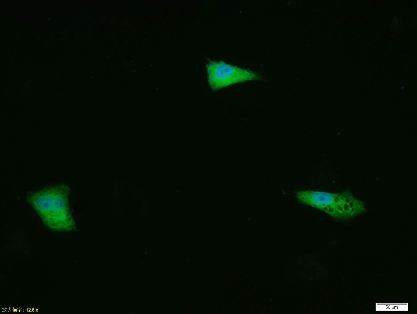 0 - phospho-ERK1/2 (Thr202 + Tyr204) Rabbit pAb AP94421